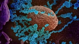Image of the coronavirus through a microscope. 